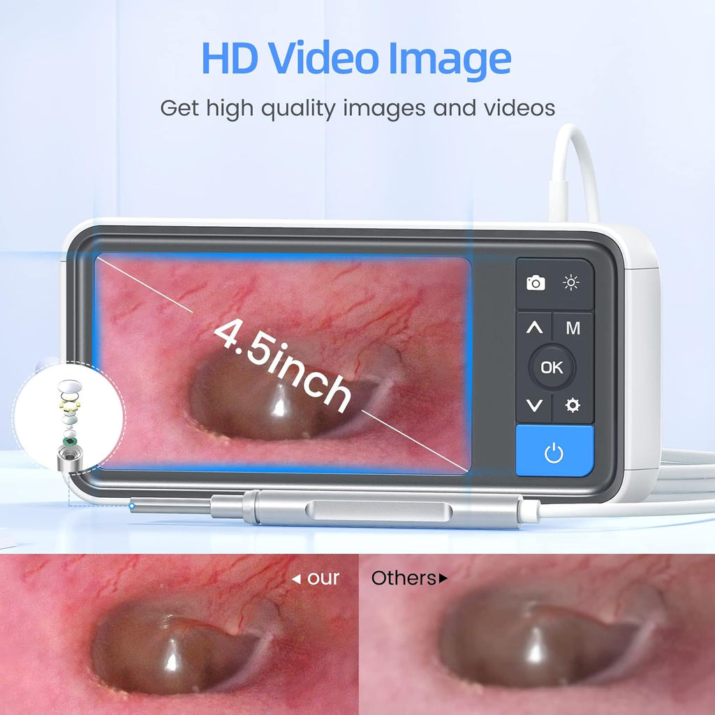 1080P HD Ear Wax Removal Otoscope with IPS Screen and 32G Card S148